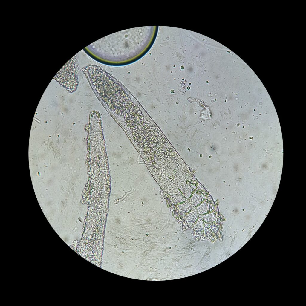 acari demodex rogna demodettica al microscopio