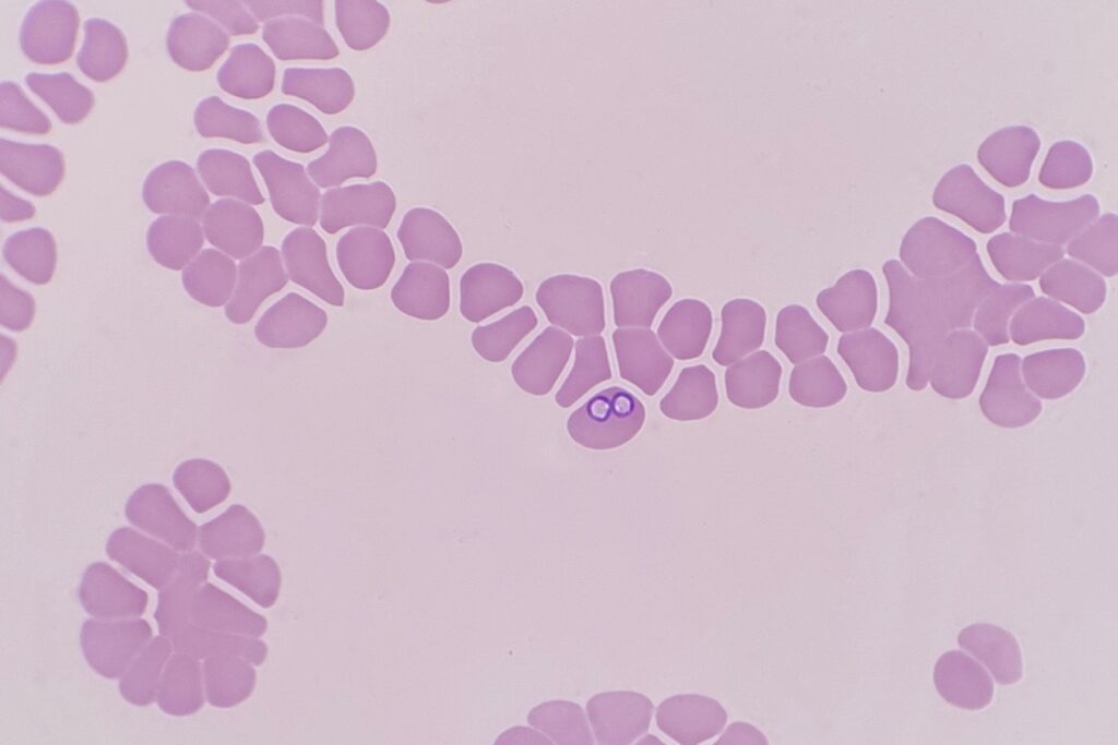 Prassita Babesia al microscopio