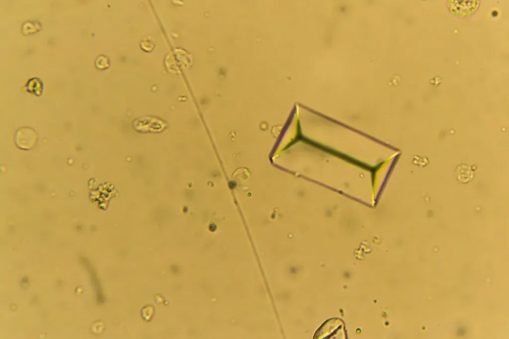cristalli struvite cane al microscopio